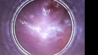 PJGIRLS - Silvie DeLuxe - RAW endoscopic video